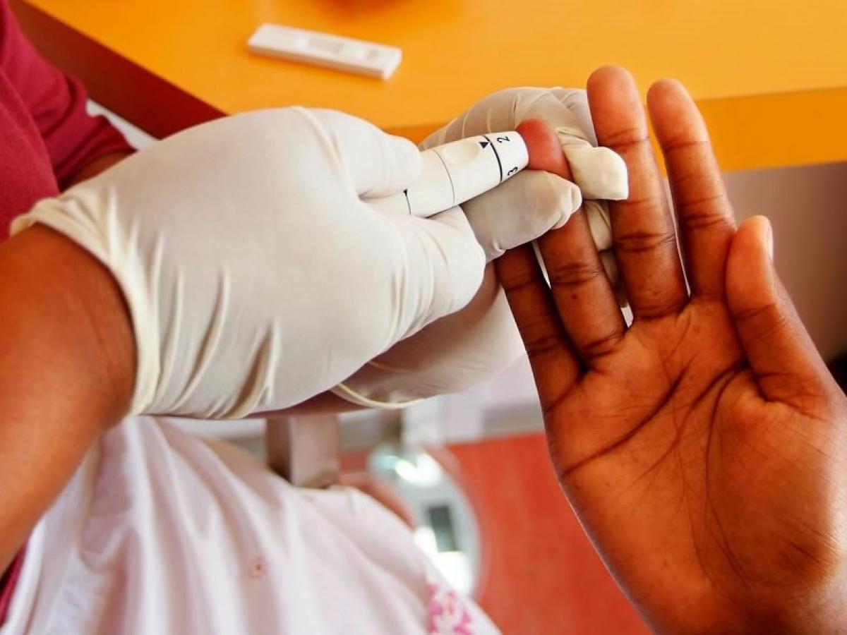 Гепатит можно мочить. HIV. HIV Testing. HIV and sida picture.