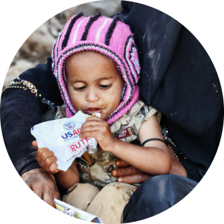 Child in Yemen with ready-to-use therapeutic food